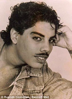 Жертва инъекций бетона показала новое лицо