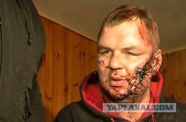 Паралимпиада: всего один украинец