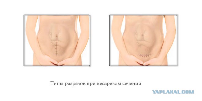 ������� ���� ������� �� ������ �� ������, ��������� �������� ����� �����