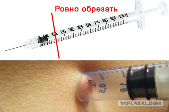 Как вытащить клеща ниткой