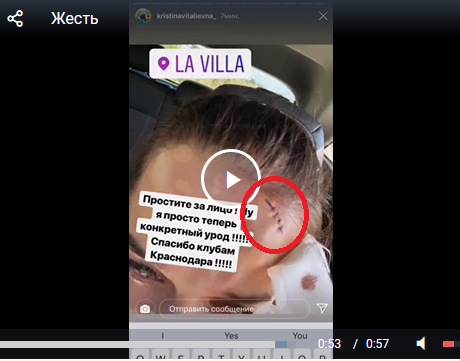 В ночном клубе Краснодара девушке порезали лицо