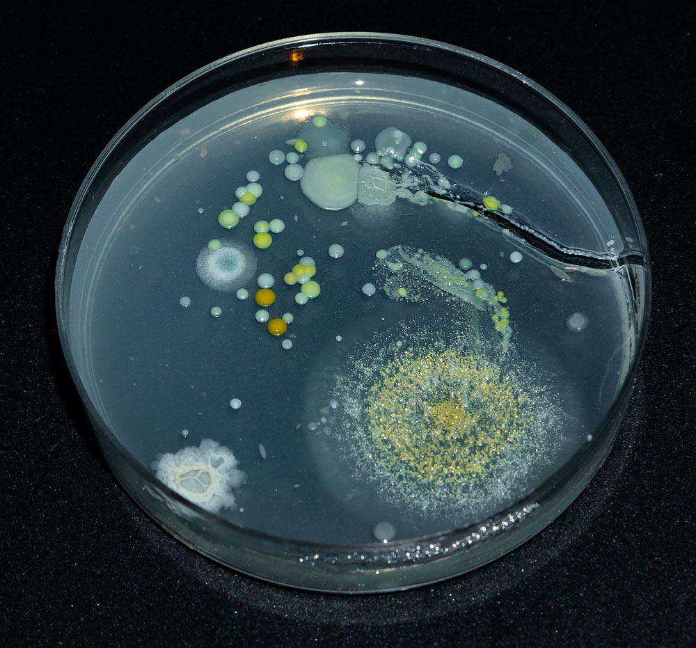 Бактерии домашних условиях. Бактериальная колония микробиология. Колонии бактерий в чашке Петри. Колония микроорганизмов это. Разноцветные колонии бактерий.