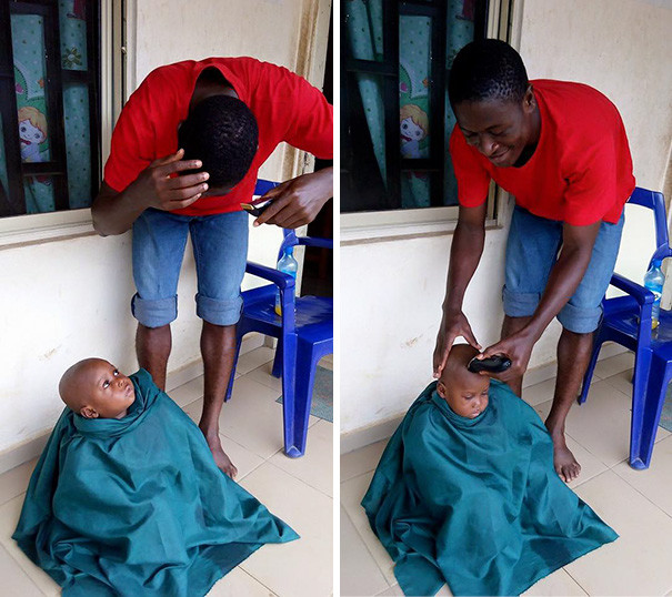 Как стал выглядеть спасенный мальчик, едва не умерший от недоедания