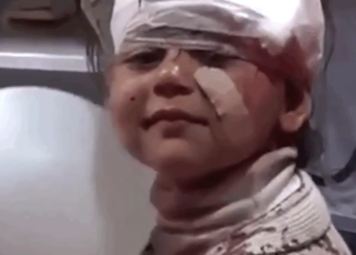 Улыбка сирийской девочки, которая выжила после ужасного теракта