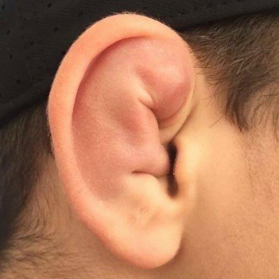 Светка, почему у тебя уши постоянно красные!?