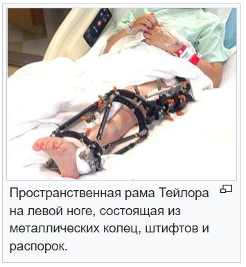 Германия. Бенз. Что? Почти всё?