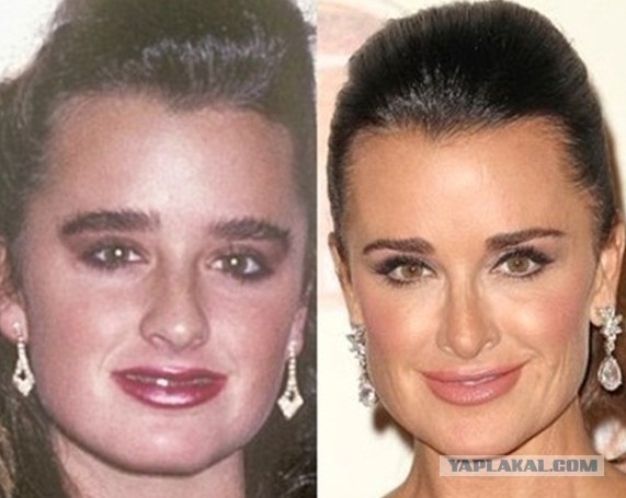 Знаменитости, которые безобразно стареют