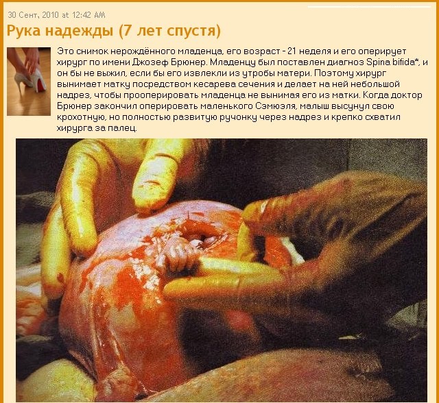 Яжмать - это диагноз