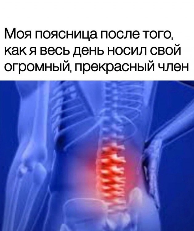 История моей борьбы с больной спиной
