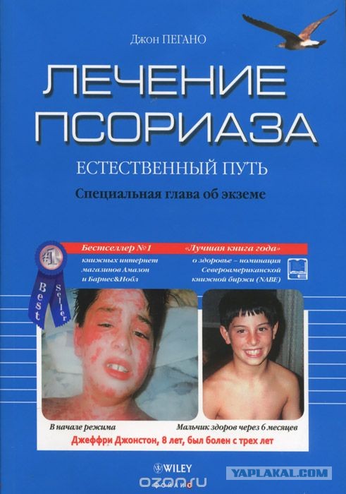 В Москве врачи вылечили мужчину с полным поражением кожи псориазом