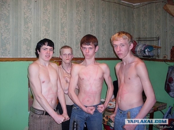 Это, блеать, болезнь уже такая? Как "белый" грипп?