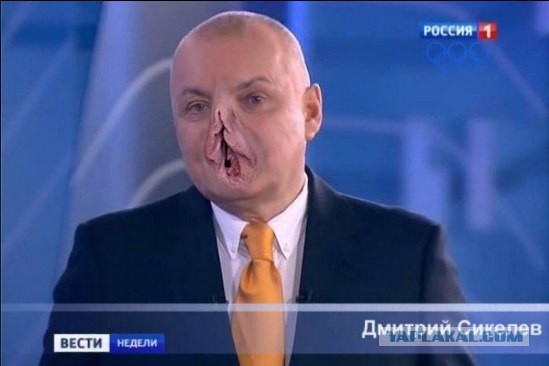 У Обамы парафрения