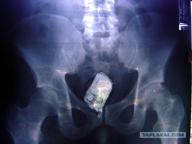 Просто в шоке