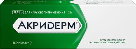 Экзема