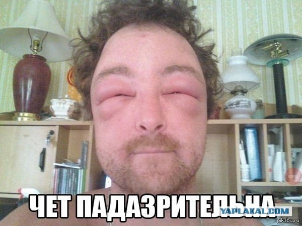 Ким Чен Ын впал в кому после кровоизлияния в мозг и экстренно госпитализирован на лечение в пекинскую больницу