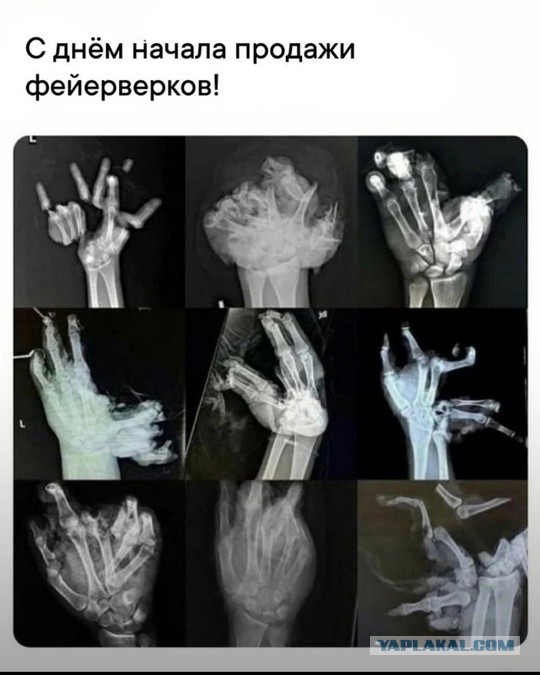 Юноше оторвало кисть на фуд-корде ТЦ в Нижнем Новгороде от взрыва петарды