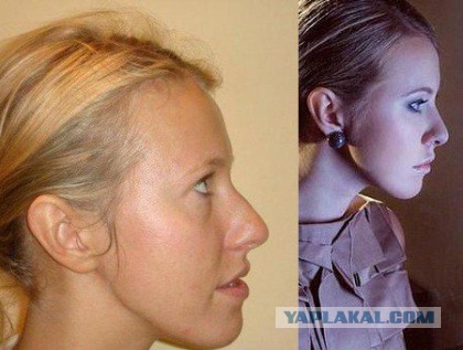 Собчак сравнила себя с Поклонской