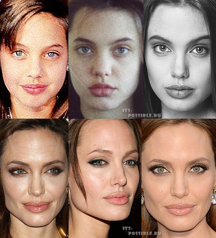 Анджелина джоли до пластики. Анжелина Джоли до и после пластики. Анджелина Джоли пластика. Нос Анджелины Джоли до и после.