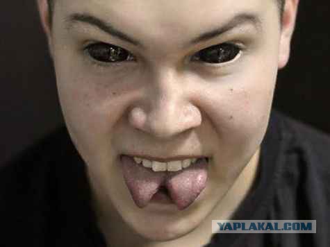 "Отпилите мне ногу": зачем россияне добровольно становятся инвалидами