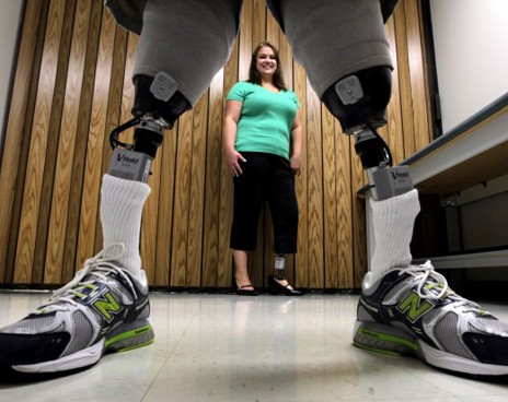 Мои вторые ноги