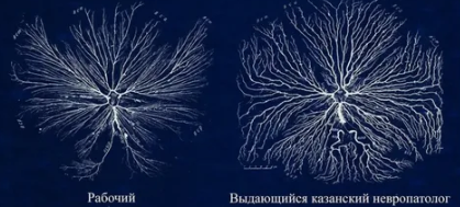 Мозг Ленина станет основой для новейшей российской нейросети