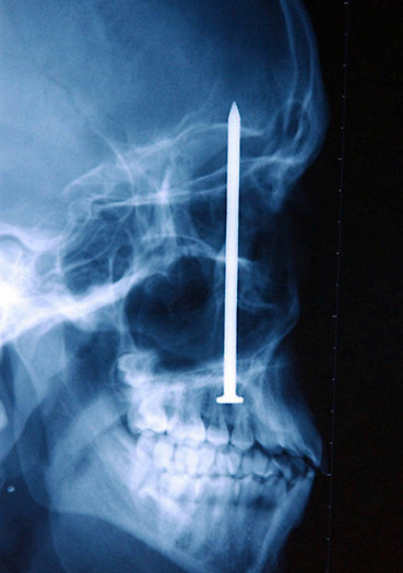 12 рентген‑фотографий, которые доказывают: идиотизм неистребим