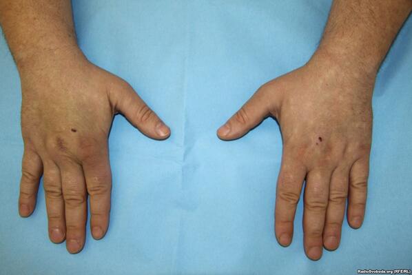 Похищения активистов Беркутом...