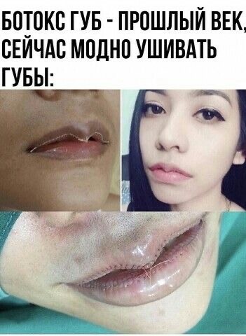 «Иглы толстоваты» или как себе в домашних условиях губы иголками увеличивают