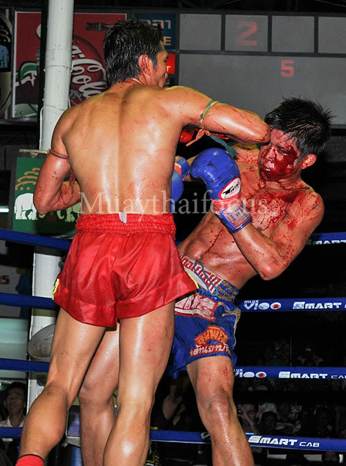 После ссоры с парнем-кикбоксером девушка обзавелась незавидной улыбкой