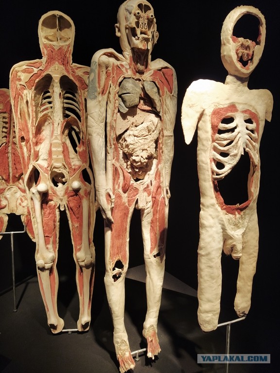 Посетил выставку Body Worlds на ВДНХ