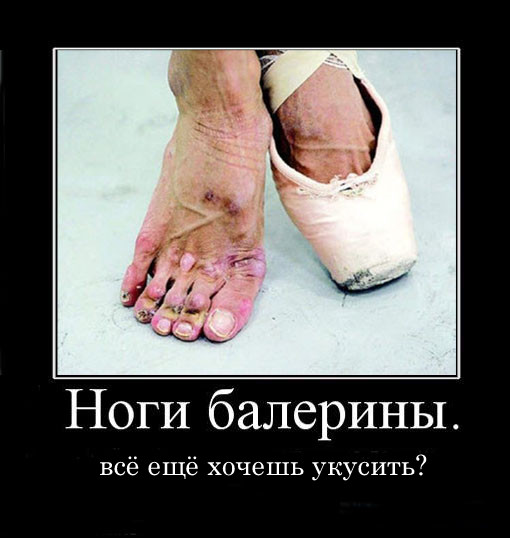 Волочкову на отдыхе в Турции укусили