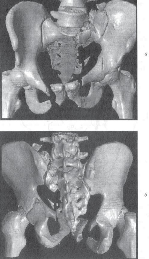 Очередная ТП за рулем