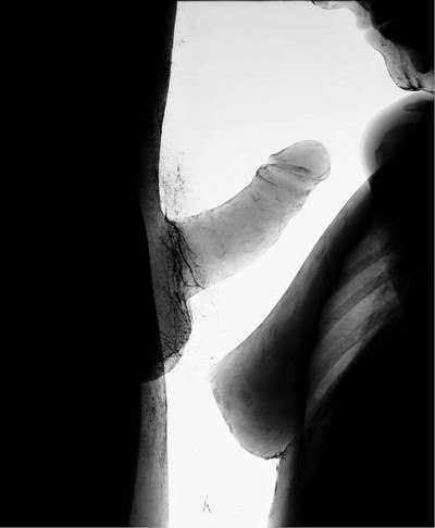 foto-mineta-pod-rentgenom