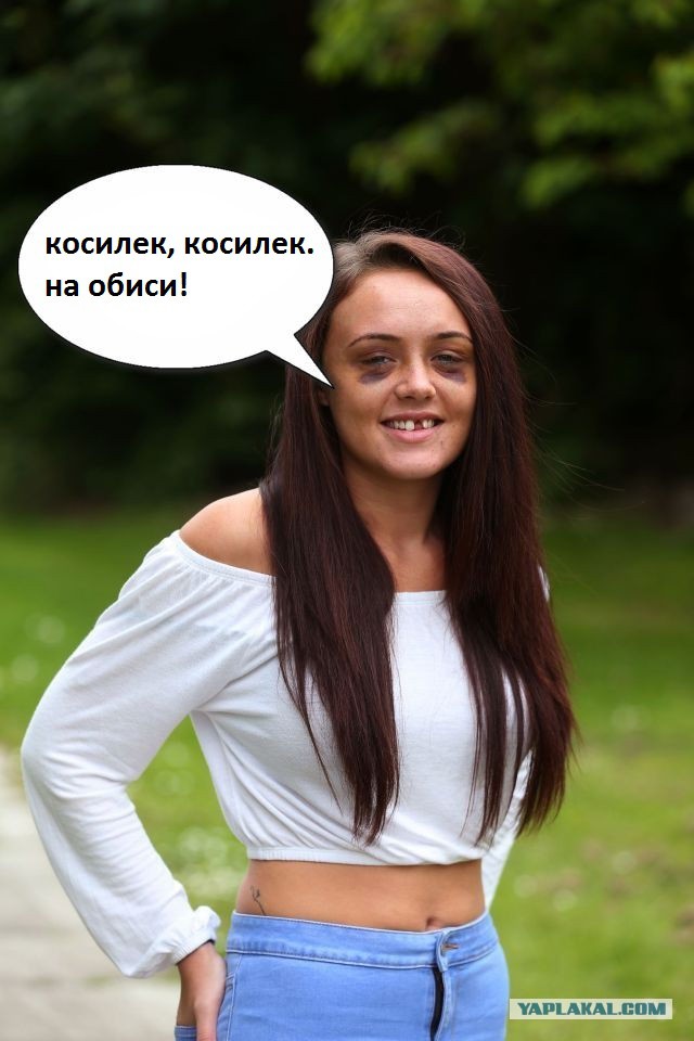 После ссоры с парнем-кикбоксером девушка обзавелась незавидной улыбкой
