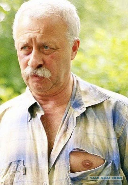 "Соскочило": случайные оголения знаменитостей на публике