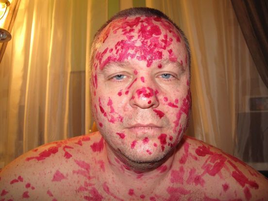 Всем зеленки!