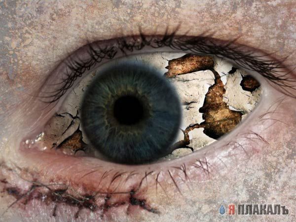 ГЛАЗА разные бывают