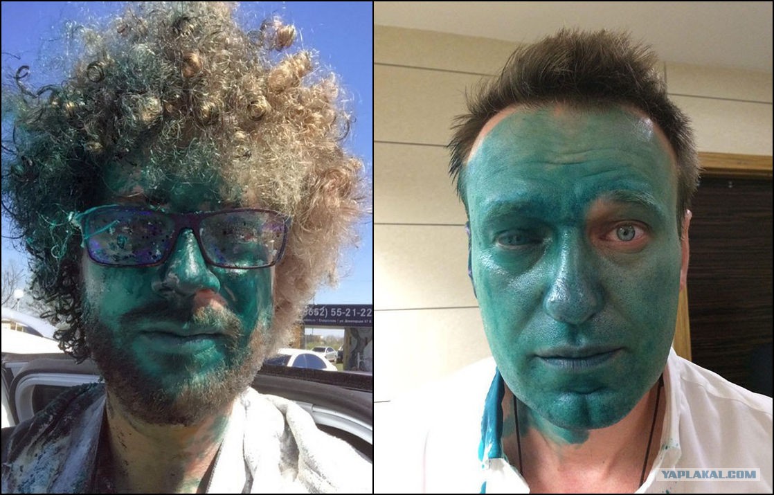 Зеленеет какое лицо. Навального облили зелёнкой. Варламова облили зеленкой.
