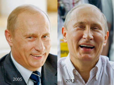 Путин  после операции стал "Удмуртом?"