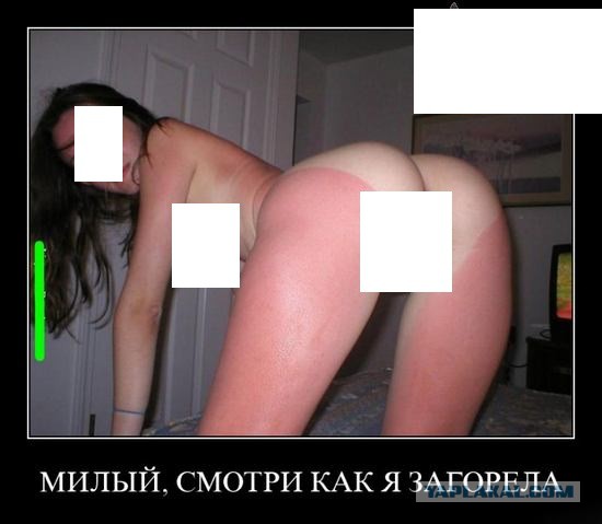 Обнаружил у жены ссадины на коленках