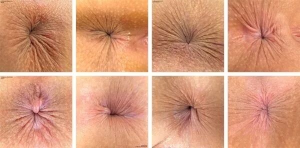 Хирург устроил фотосессию ануса россиянки под наркозом