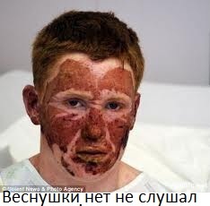 Интересные факты про веснушки