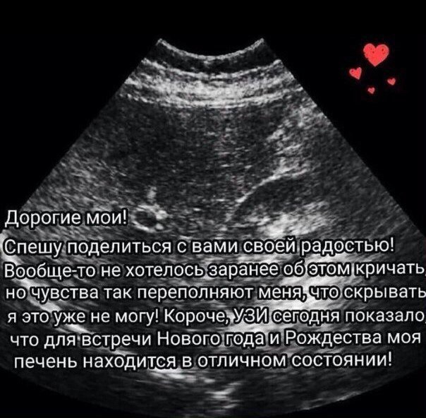 Подборка интересных и веселых картинок