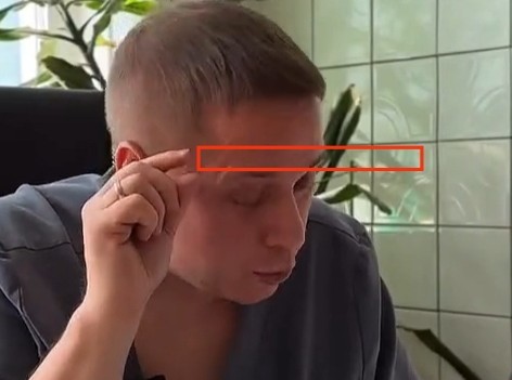 Нарколог про любителей по чуть-чуть