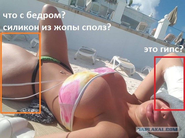 "Утиные губки" что - все еще в моде?!