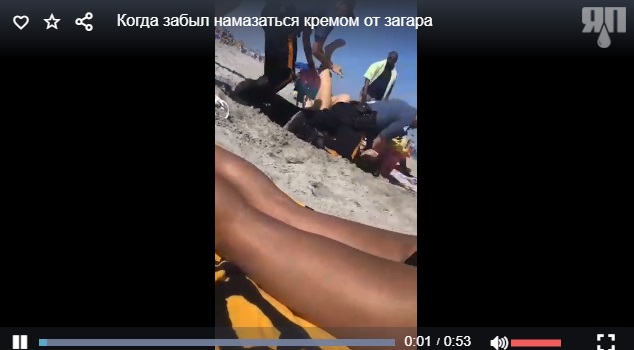 Когда забыл намазаться кремом от загара
