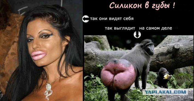 Трудовые мозоли