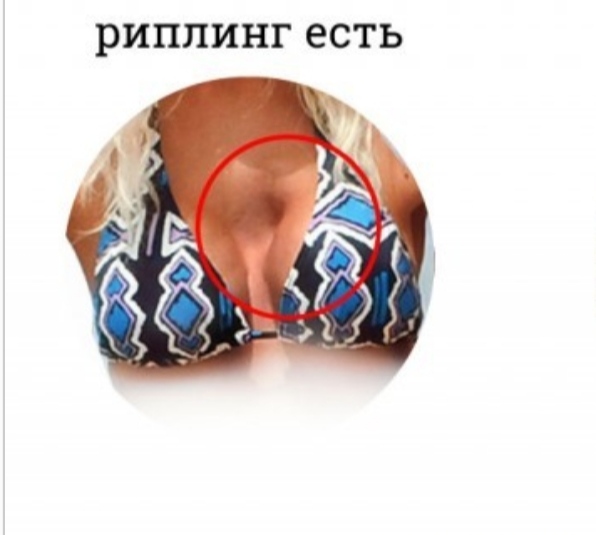Силиконовая или натуральная? Как распознать грудь на пляже знойным летом