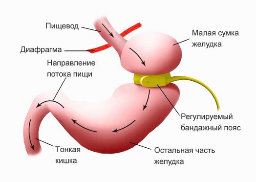 А похудеть не пробовала?