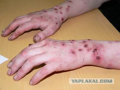 Селфи врачей «скорой» с окровавленным пациентом
